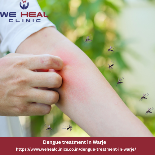 Dengue treatment in Warje