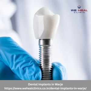 Dental implants in Warje
