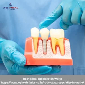 Root canal specialist in Warje