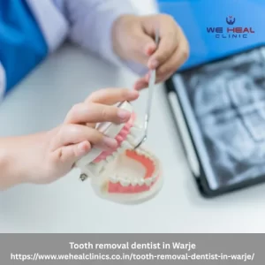 Tooth removal dentist in Warje